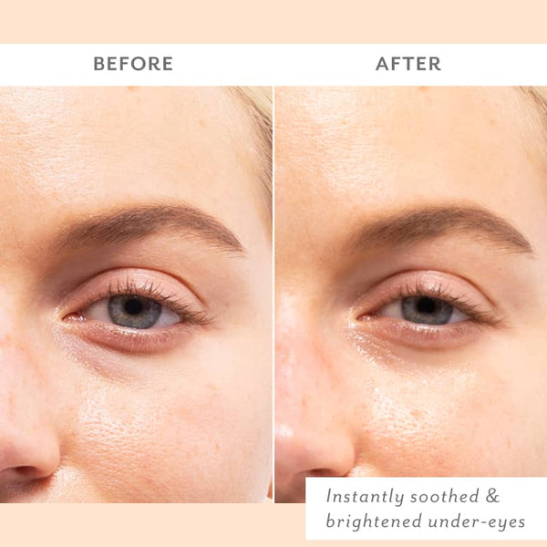 Patchology: Skin Remedy Soothing Eye Gels - Single Pack